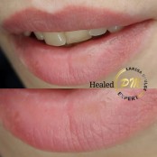 Перманентный макияж губ,зажившие